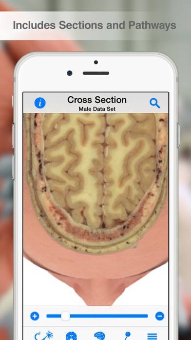 Pocket Brain Captura de pantalla de la aplicación #4
