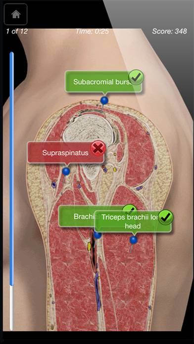 Shoulder Pro III App screenshot