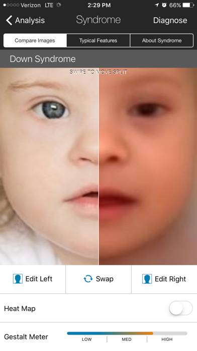 Face2Gene Capture d'écran de l'application