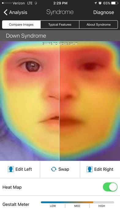 Face2Gene capture d'écran