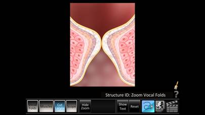 Vocal Folds ID App skärmdump #3