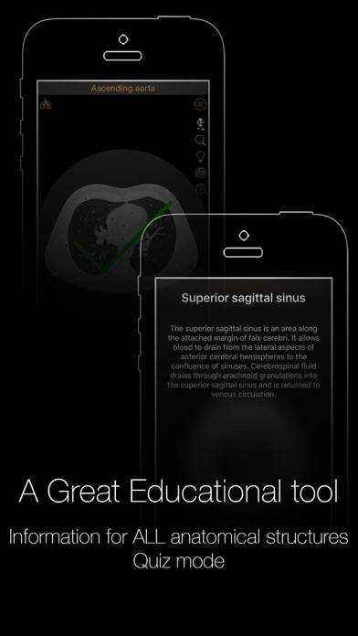CT Anatomy App screenshot #3