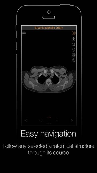 CT Anatomy App screenshot #5