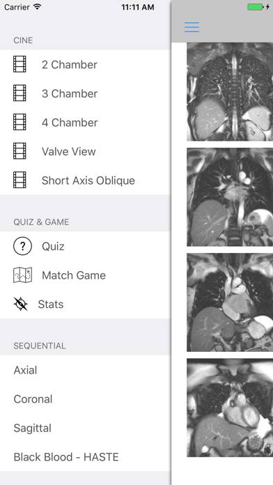 IAnatomy-Cardiac Schermata dell'app #1