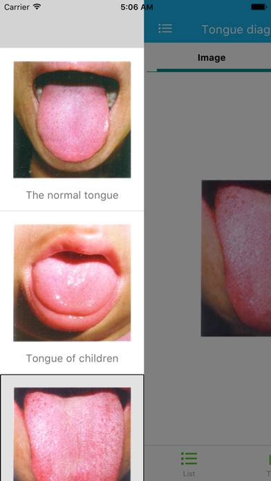 Tongue diagnosis handbook App screenshot #1