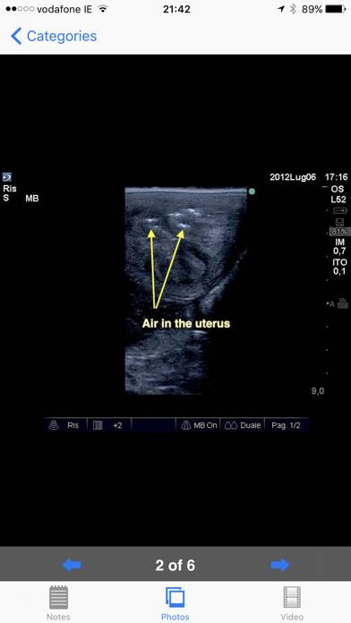 Equine Reproductive Ultrasound Captura de pantalla de la aplicación #1