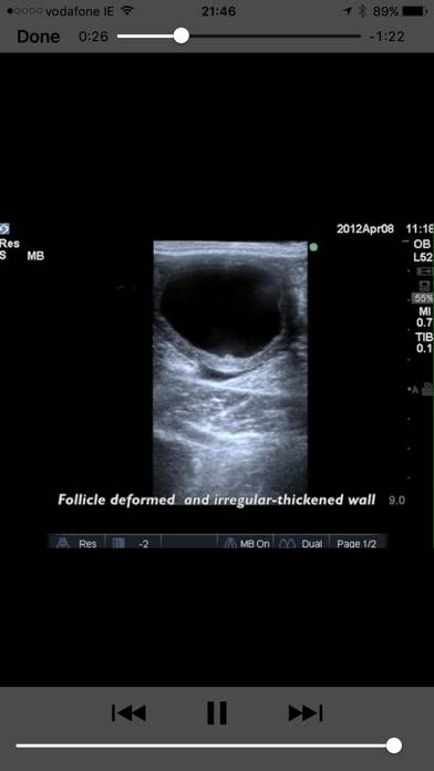Equine Reproductive Ultrasound Captura de pantalla de la aplicación #2