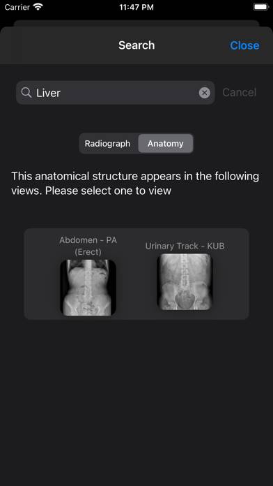 Xray Anatomy Captura de pantalla de la aplicación #5