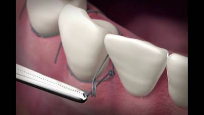 The Oral Surgery Suture Trainer Capture d'écran de l'application #3