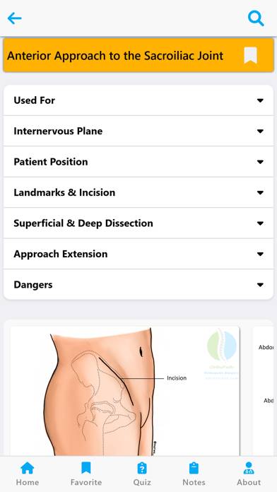 Orthopedic Surgery Approaches Schermata dell'app #6
