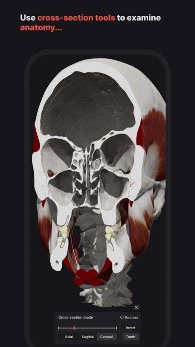 Skull, Teeth & TMJ Schermata dell'app #4