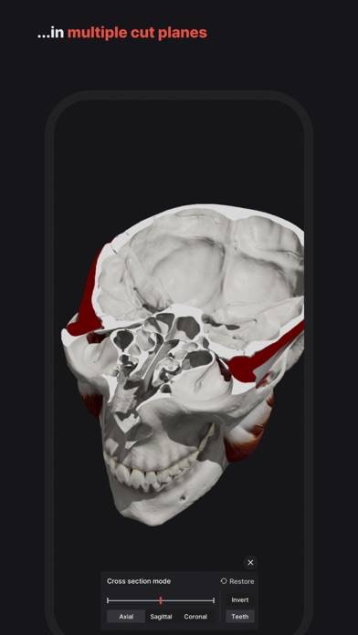 Skull, Teeth & TMJ Schermata dell'app #5