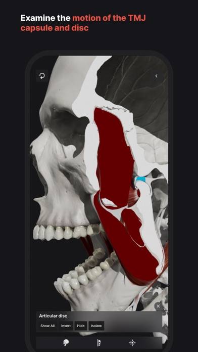 Skull, Teeth & TMJ Schermata dell'app #6