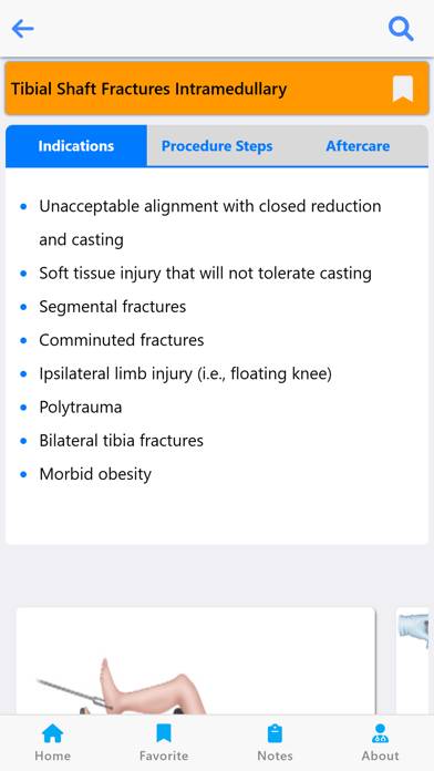 Orthopedic Surgery Techniques App screenshot #6