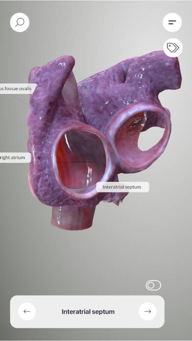 3D Heart Anatomy Captura de pantalla de la aplicación #5