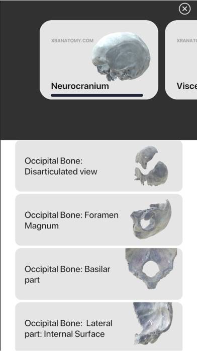 3D Osteology App screenshot #4
