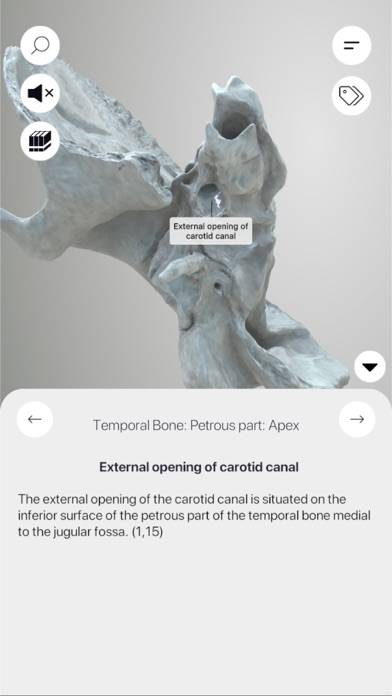 3D Osteology App-Screenshot #6