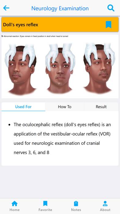 Neurology Examination & Review Schermata dell'app