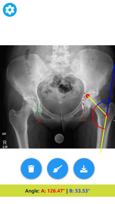 Angle Meter & Cobb Angle Meter Schermata dell'app