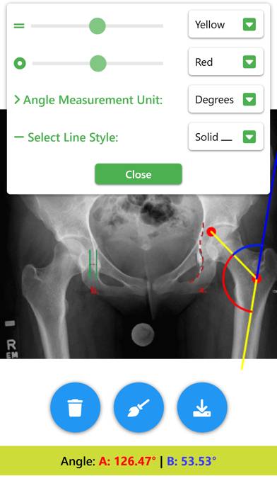 Angle Meter & Cobb Angle Meter Schermata dell'app