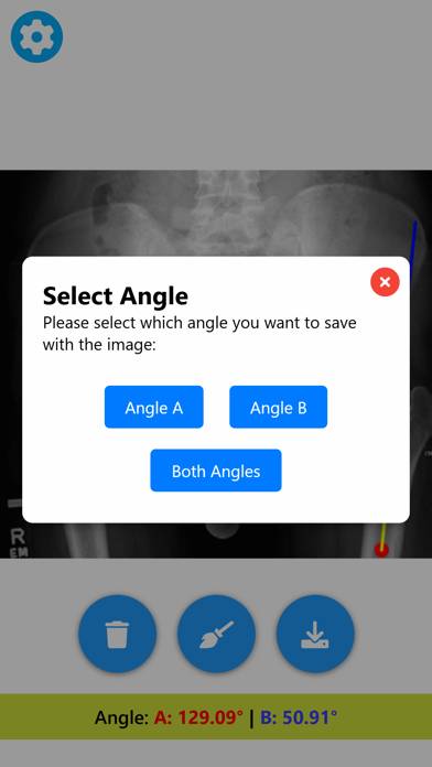Angle Meter & Cobb Angle Meter Schermata dell'app