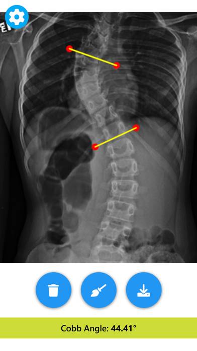 Angle Meter & Cobb Angle Meter Schermata dell'app