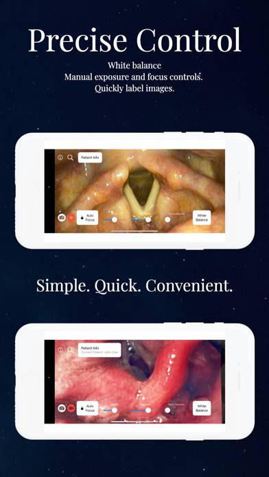 Endoscope App Capture d'écran de l'application #3