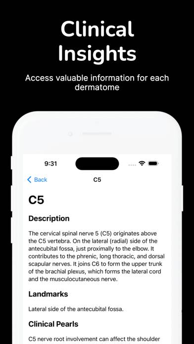 Dermatome Map and Tuning Fork App-Screenshot