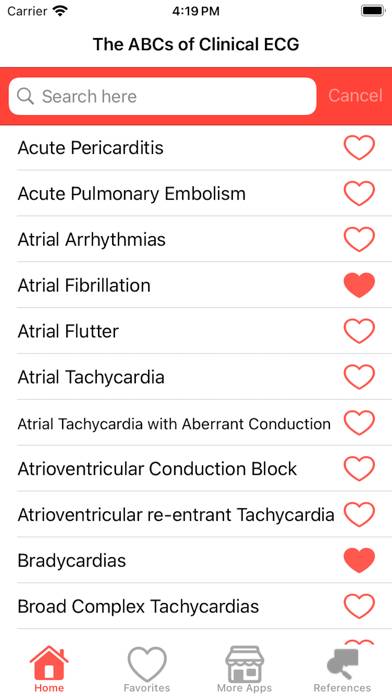 Clinical ECG Interpretation