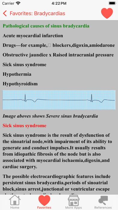 Clinical ECG Interpretation App screenshot