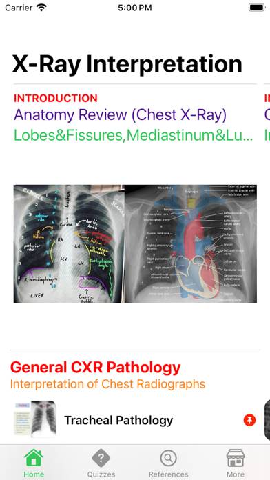 X-Ray Interpretation Guide Captura de pantalla de la aplicación