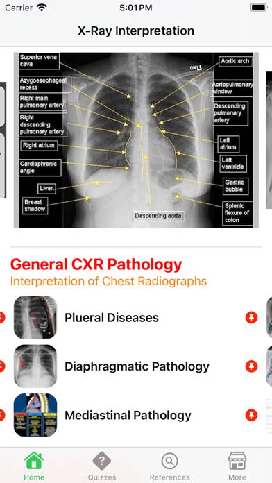 X-Ray Interpretation Guide Captura de pantalla de la aplicación