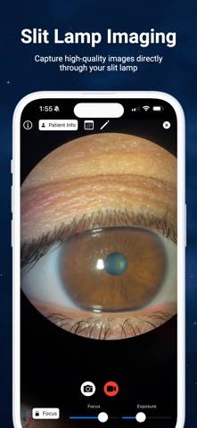 Slit Lamp Camera