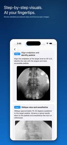 Advanced Pain Procedure Guide App screenshot