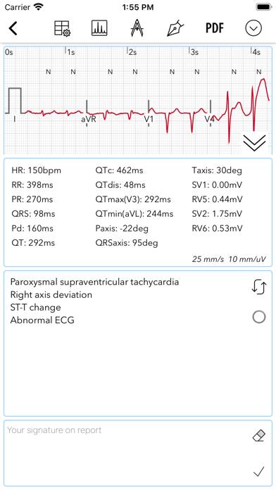 ECG Pro for Doctors App screenshot #4