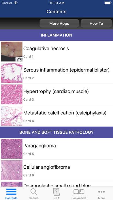 Anatomic Pathology Flashcards screenshot