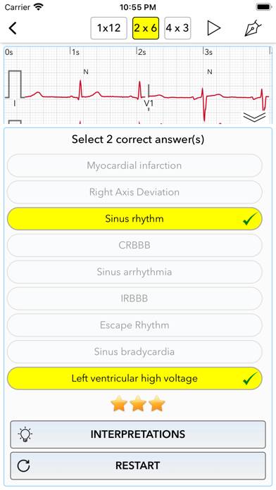 ECG Test Pro for Doctors App screenshot #4
