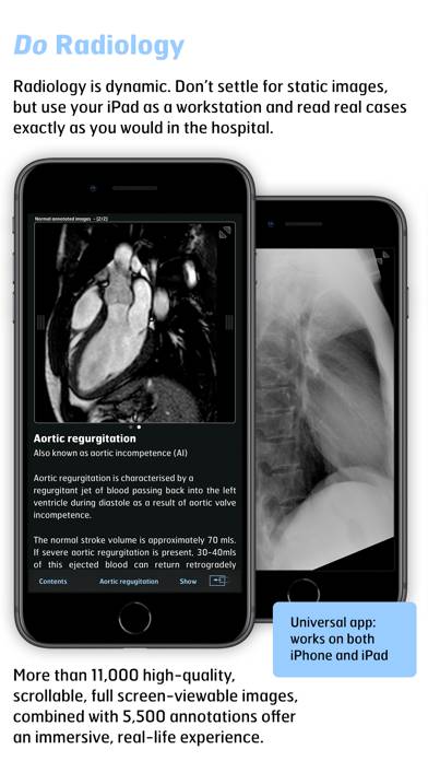 Thoracic Imaging Fundamentals App skärmdump