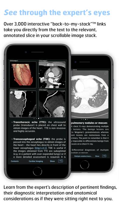 Thoracic Imaging Fundamentals App skärmdump
