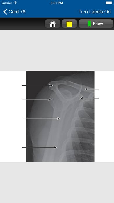 Radiographic Positioning Cards App screenshot