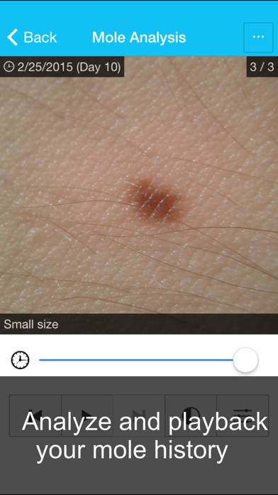 Skin Cancer App Captura de pantalla de la aplicación #3