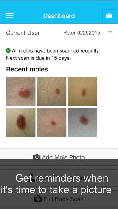 Skin Cancer App Captura de pantalla de la aplicación #4