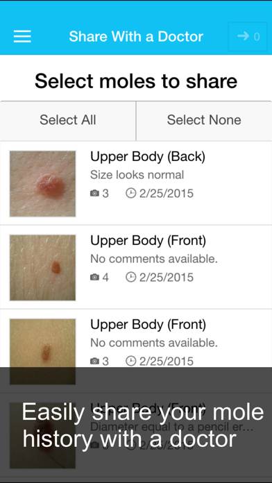 Skin Cancer App Captura de pantalla de la aplicación #5