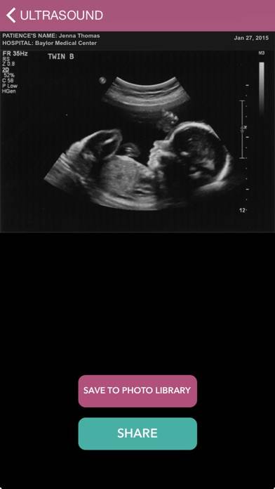 Baby Ultrasound 2015 App screenshot #1