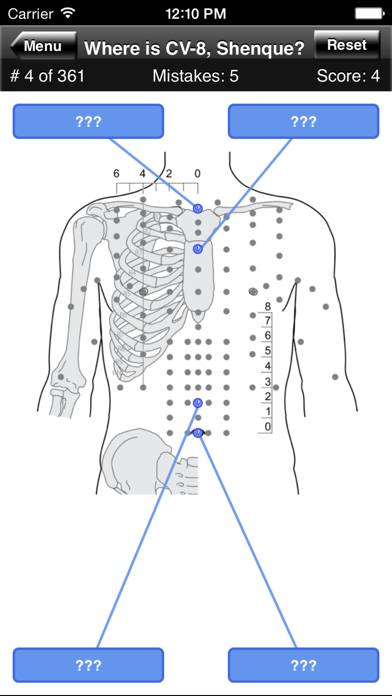 Acupuncture Points Body Quiz App-Screenshot #2
