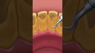 Happy Screw Merge immagine dello schermo