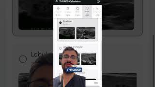 Easy TI-RADS Calculator captura de pantalla